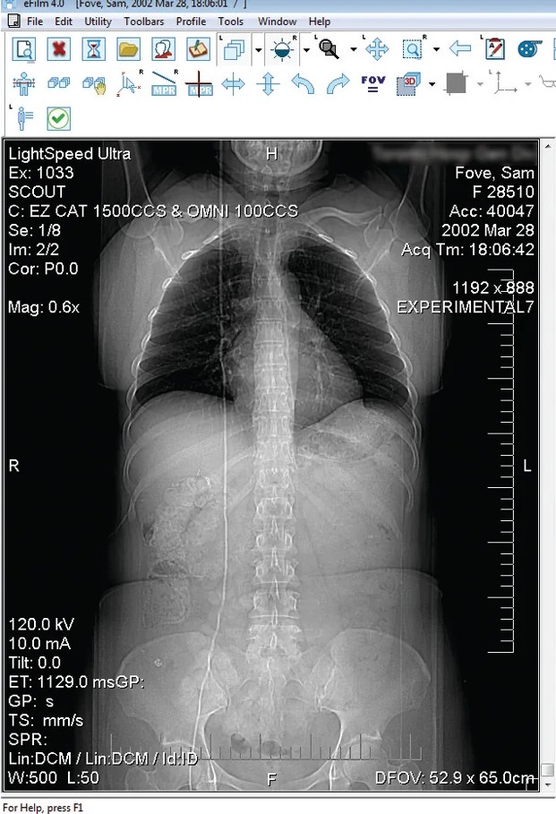 Endoscopía - Captura en vivo con control remoto