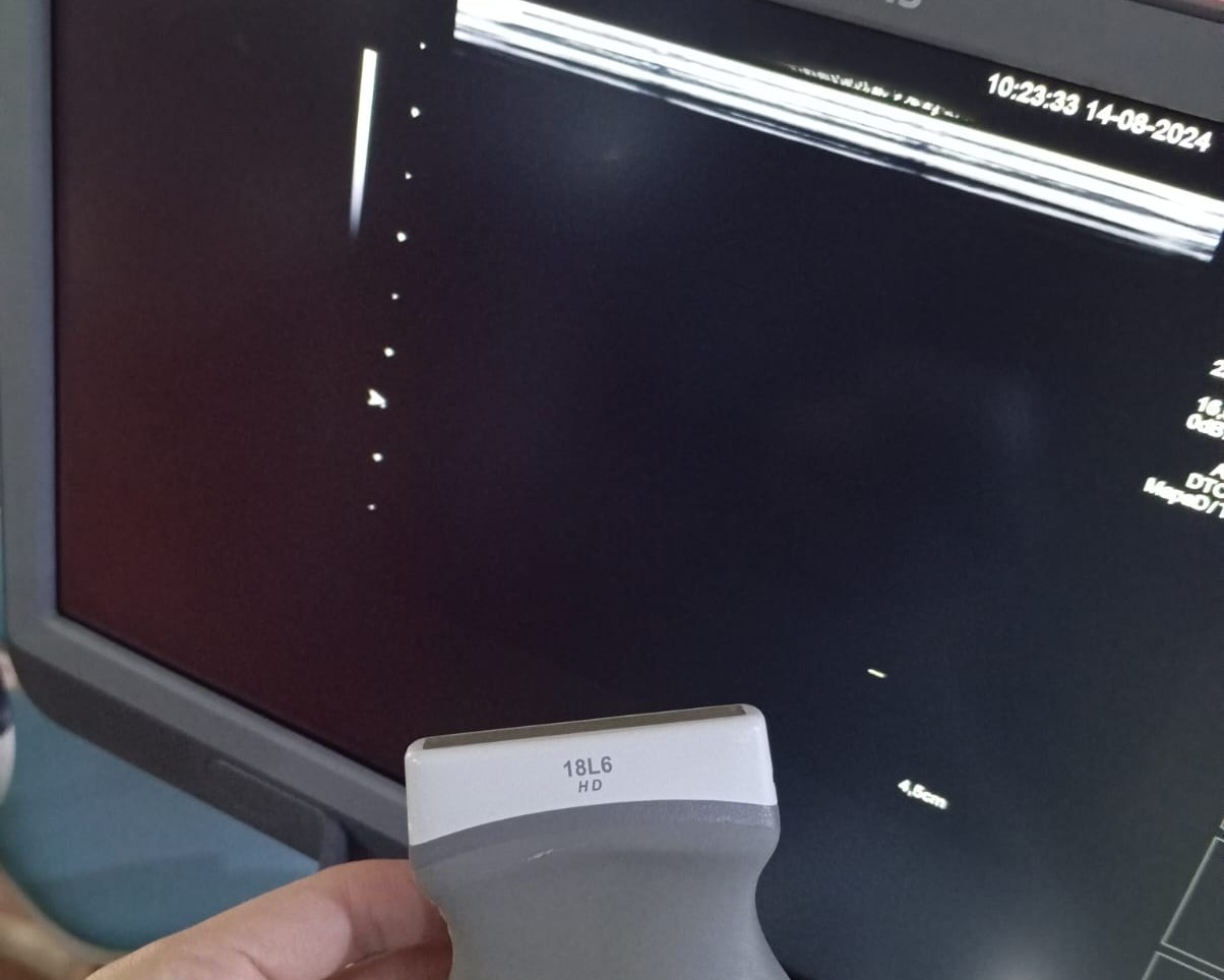 Mantenimiento en terreno de equipos médicos