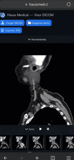 Visor DICOM integrado al sistema RIS/PACS en desarrollo para gestión de estudios de imagenología