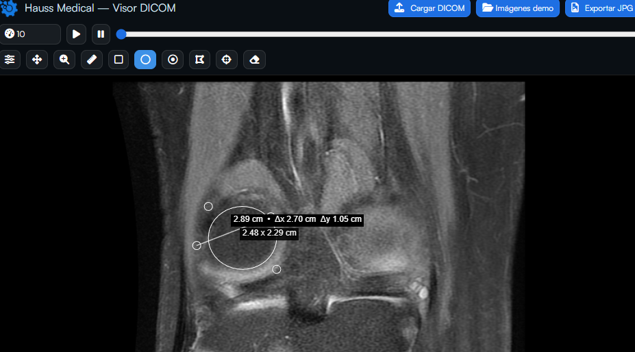 Pantalla principal del visor DICOM conectado a sistema RIS/PACS de Hauss Medical