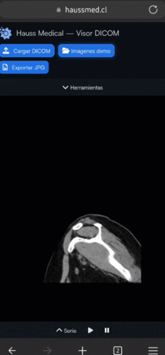 Visor DICOM mostrando estudios médicos dentro de una plataforma RIS/PACS